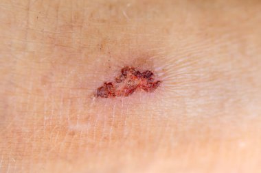 Derisi olan insan dizi