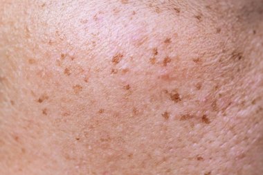 Siyah saçlı bir adama yaklaş.