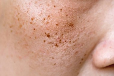 Kahverengi tenli kadın