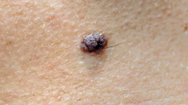 İnsan derisine yakın, derma, dermatma, ayrıca siyah derma dermasi olarak da bilinir.