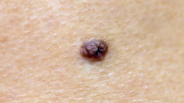 İnsan derisindeki deri dokusu, makro fotoğraf.