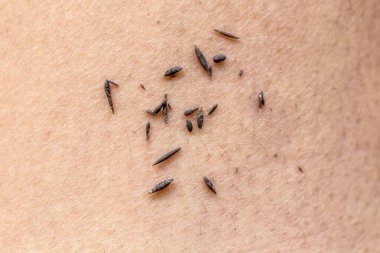 Beyaz arka planda siyah kalemle insan derisini kapat.