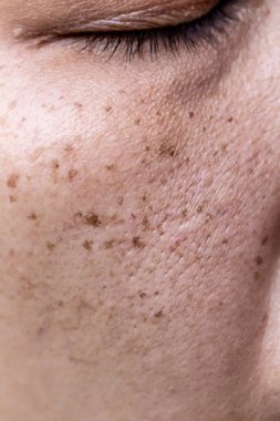 Yüzüne maske takan genç bir kadın, yakın plan, üst görüş.