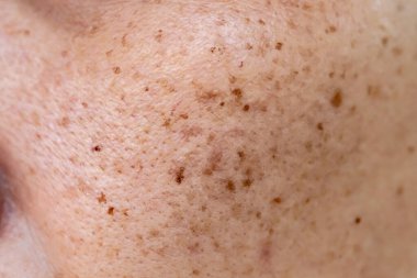 Yakından. Yüzünde kahverengi deri olan kadının yüzüne..