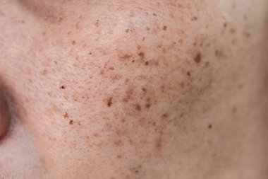 İnsan Derisinin Macro Çekimi