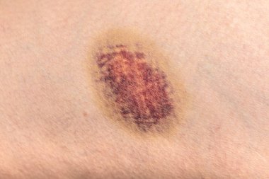 insan vücudunun dokusunu. Bir adam kırmızı bir çarşafa boyanır..