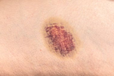 Sırtında bir kadın derisi, yakın çekim -.