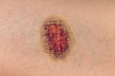 İnsan diz eklemi arkada, makro görüş.