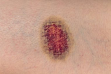 Bir kadının vücudundaki deri dokusu..