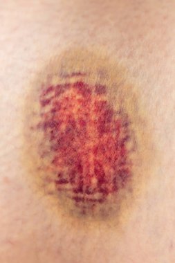 beyaz arkaplandaki bir tenin dokusu.