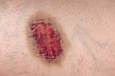 Kafesteki bir deriyi kapat.