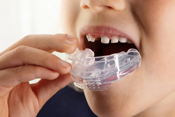 口の中にシリコーンブレースを挿入子供 口腔の習慣を矯正し顎を整えて歯を矯正し — ストック写真