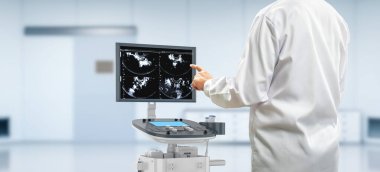 3D ultrason makinesi sonografla laboratuvarda hazırlanıyor