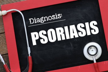 Tebeşir tahtasında steteskopun yanında PSORIASIS kelimesi. Tıbbi konsept