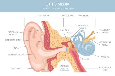 Otitis medyası. Orta kulakta enfeksiyon var. Otolojik bozukluklar bilgisi. Vektör illüstrasyonu
