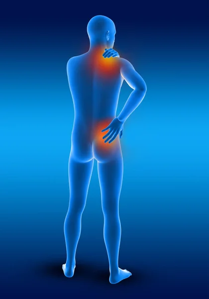 3D render of a male medical figure holding his neck and back in pain