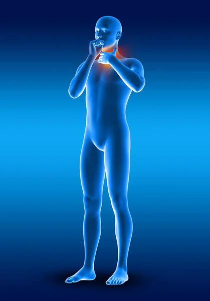 痛みの中で彼の喉を保持男性医療フィギュアの3Dレンダリング — ストック写真
