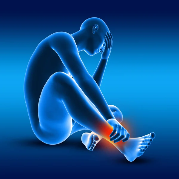 3D render of a male medical figure holding his ankle in pain