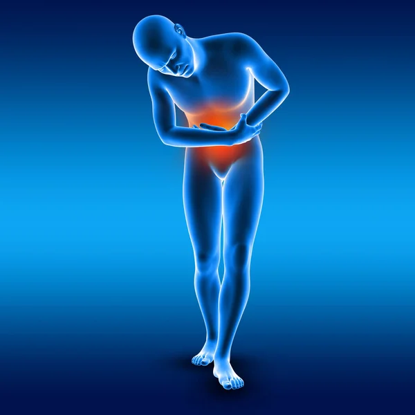 Renderowanie Męskiej Postaci Medycznej Trzymającej Żołądek Bólu — Zdjęcie stockowe