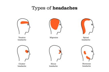Baş ağrısının yeri belli. Basit bir bilgi. Vektör illüstrasyon sağlık kavramı.