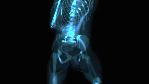 Abstract Design Backpain — Stock Photo, Image