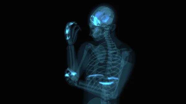 肘の痛みの3D抽象的な解剖学的概念 — ストック写真