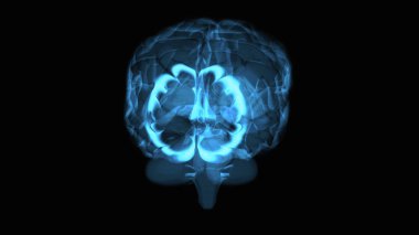3D abstract art of a brain 