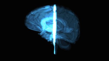 3D abstract art of a brain