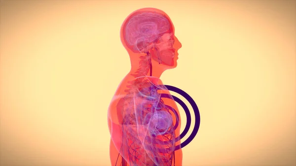 要約心臓発作 健康の3Dイラスト — ストック写真
