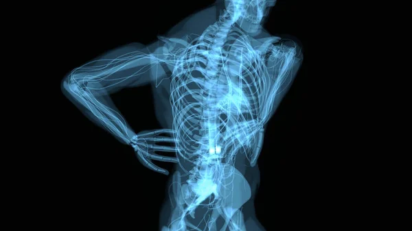 Abstract Illustration Backpain — Stock Photo, Image