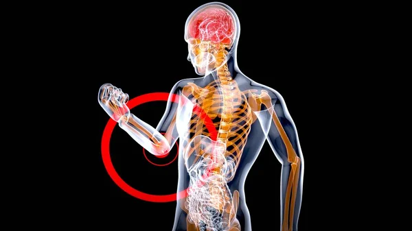 Anatomi Begreppet Armbåge Smärta — Stockfoto