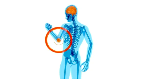 肘の痛みの解剖学的概念 — ストック写真