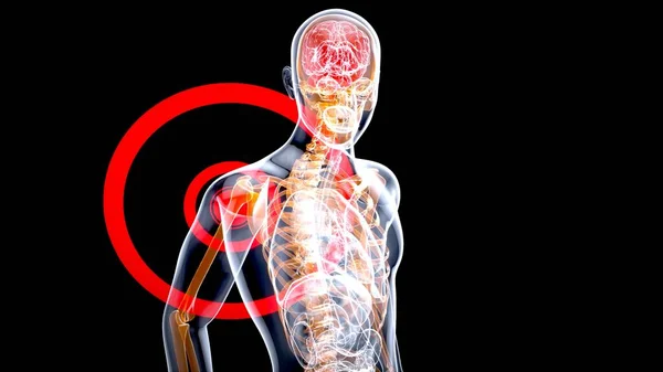 Анатомическая Концепция Боли Плече — стоковое фото