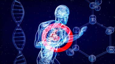 Bir kalp krizinin üç boyutlu çizimi