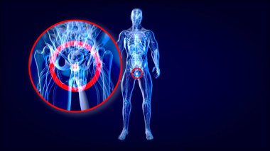 Prostatın anatomisinin 3 boyutlu soyut çizimi