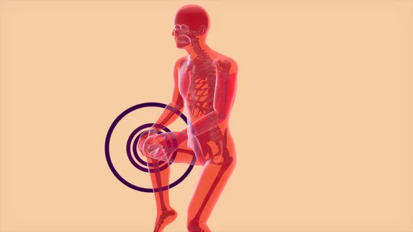 膝关节疼痛的3D抽象解剖概念 — 图库照片