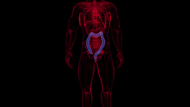 结肠癌的三维图像 — 图库视频影像