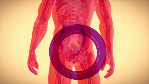 结肠癌的抽象动画 — 图库视频影像