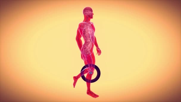 骨关节炎和膝关节病变的抽象动画 — 图库视频影像