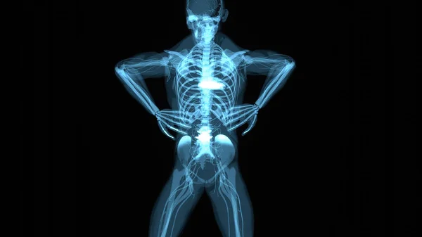 背痛男子的解剖学概念 — 图库照片