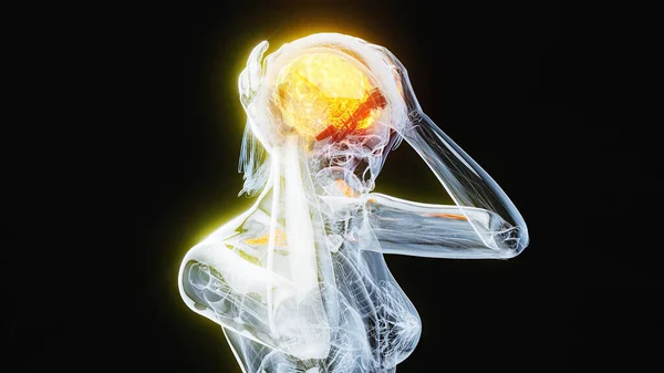 Ilustrasi Abstrak Dari Wanita Yang Menderita Sakit Kepala — Stok Foto