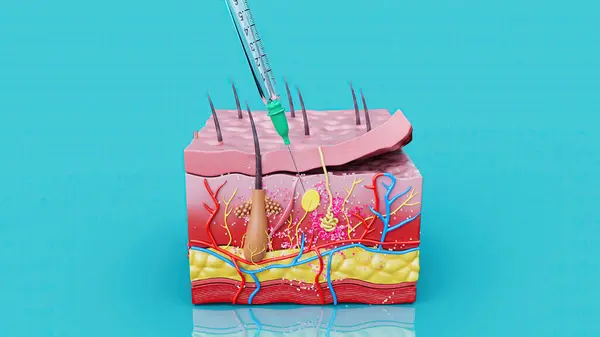Abstracte Afbeelding Van Een Subcutane Injectie Stockfoto