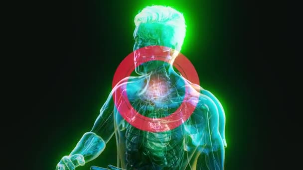 Abstrakte Animation Eines Mannes Mit Halsschmerzen — Stockvideo