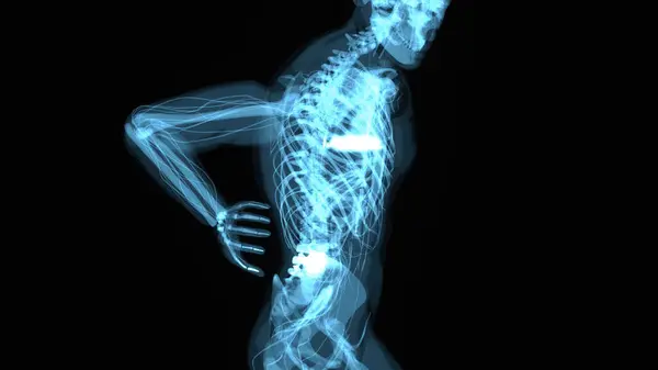 Anatomisches Konzept Eines Mannes Mit Rückenschmerzen — Stockfoto