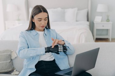 Bilgisayarın önündeki kız biyonik protez hazırlıyor. Genç Avrupalı kadın yapay eli ayarlıyor. Çekici engelli kadın evde çalışıyor. Modern biyonik protez.