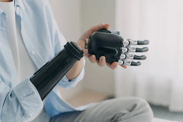 Artificial hand and arm with wrist joint. Disabled woman is disassembling prosthesis hand and arm. Bionic hand has processor chip, prosthetic sensor and buttons. High technology prosthesis.
