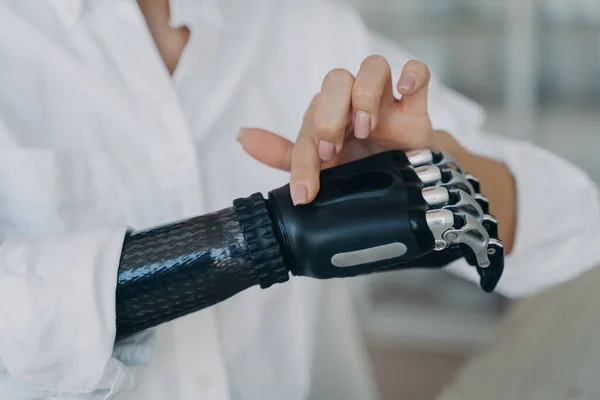 Hands of handicapped girl. Disabled young woman is setting bionic limb. Cyber prosthesis hand has processor chip, software and buttons. European girl has cybernetic carbon hand.