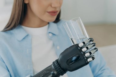Gelecekçi robotik kol protezi. Engelli Avrupalı kız elinde modern biyonik protezli bir bardak su tutuyor. Yüksek teknoloji tasarımı yapay kol. Ampütasyon sonrası sağlıklı yaşam tarzı.