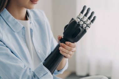 Handicapped young woman is disassembling bionic arm prosthesis. Cyber sensor hand has processor chip and buttons. Caucasian girl is amputee adjusting her electronic artificial arm at home.