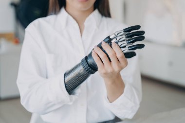 Engelli genç kadın, biyonik kolu eliyle birleştiriyor. Siber sensör elinin işlemci çipi ve düğmeleri var. Avrupalı kız, çağdaş elektronik el protezini evde ayarlıyor.